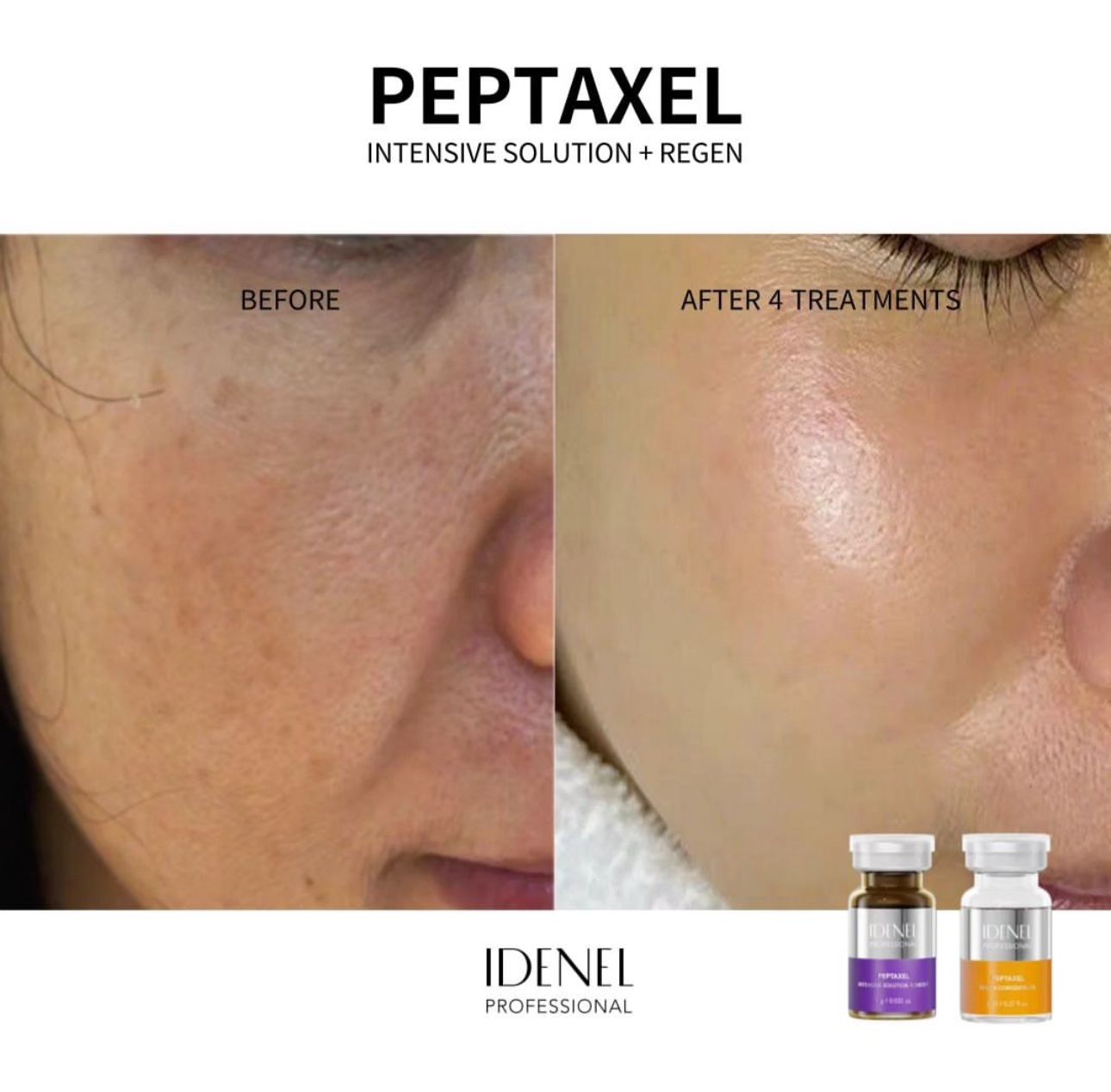 IDENEL dermokozmetika